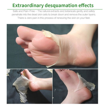 Foot peelmask